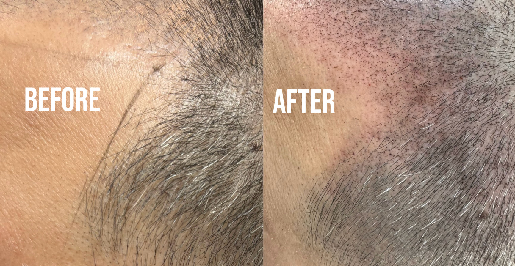 confont.ink(コンフロントインク) THE SCALP INK®